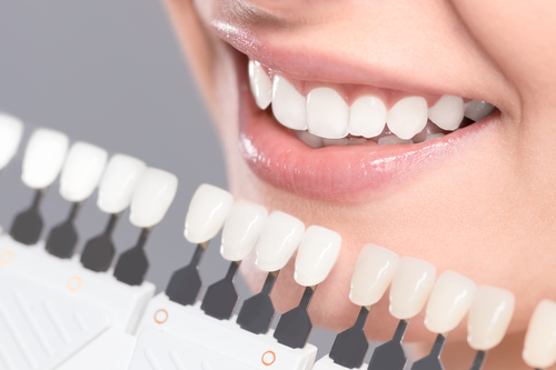 Zoom Teeth Whitening | Lincoln Square, Chicago | Dental Innovations