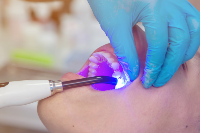 zoom teeth whitening chicago zoom teeth whitening chicago