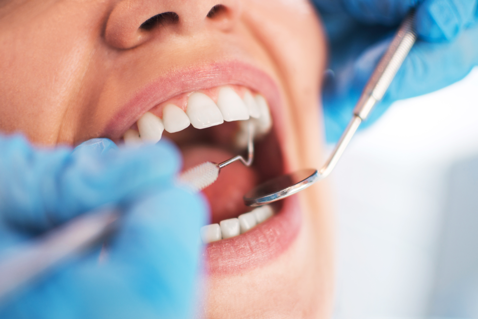 The Benefits of Good Oral Hygiene Dental Innovations 