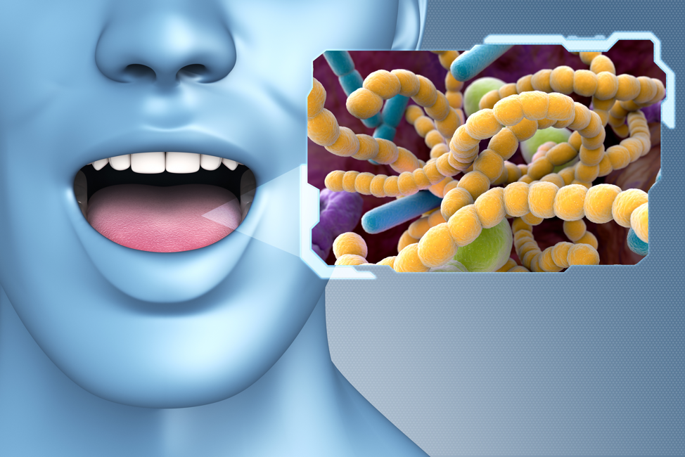halitosis-bad-breath-bacteria